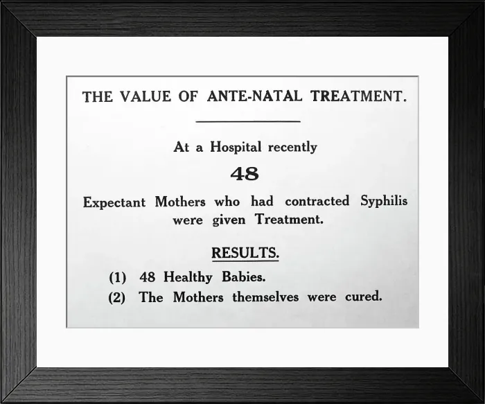Framed Print : Syphilis and pregnancy, 1920s projection slide Framed Print : Syphilis and pregnancy, 1920s projection slide