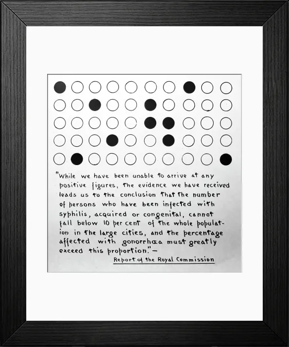 Framed Print : Syphilis in the UK population, 1920s projection slide Framed Print : Syphilis in the UK population, 1920s projection slide