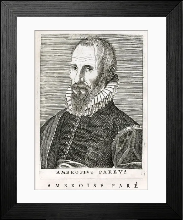 Framed Print : Ambrose Pare Framed Print : Ambrose Pare