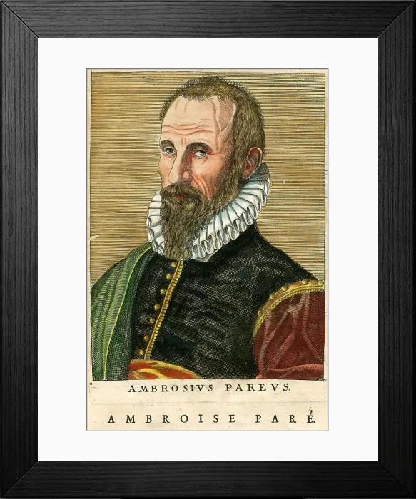 Framed Print : Ambrose Pare Framed Print : Ambrose Pare