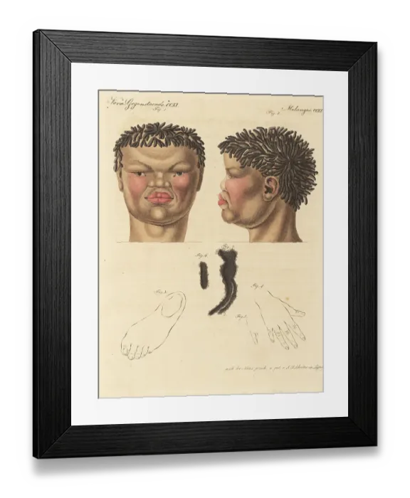 Framed Print : Head of a 20-year-old Khoekhoe man of South Africa, 1814