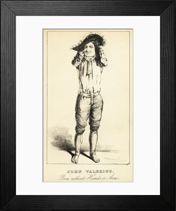 Framed Print : John Valerius, born without hands or arms, 18th century Framed Print : John Valerius, born without hands or arms, 18th century