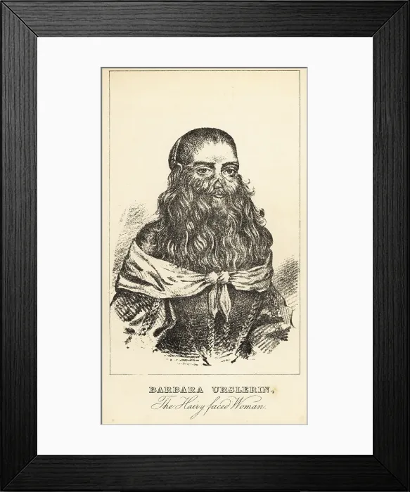 Framed Print : Barbara Urslerin, the hairy-faced woman, 17th century Framed Print : Barbara Urslerin, the hairy-faced woman, 17th century