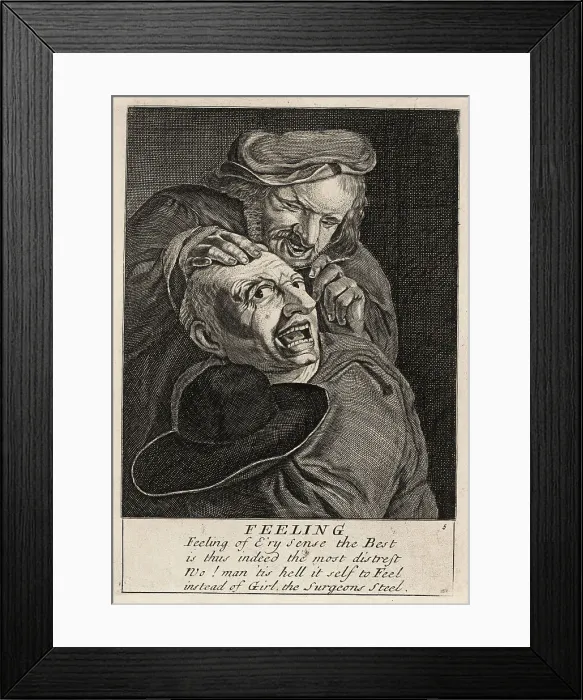 Framed Print : 17th century English barber-surgeon operating on a man's head wi Framed Print : 17th century English barber-surgeon operating on a man's head wi