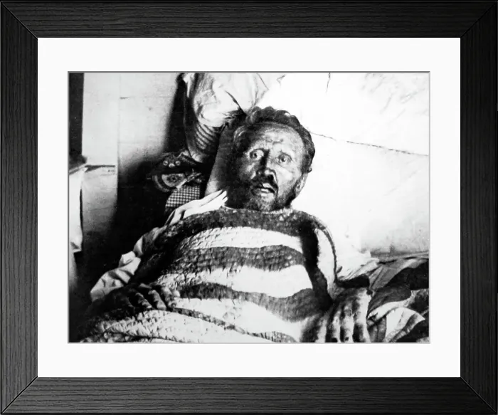Framed Print : Father Damien on his death bed in 1889 Framed Print : Father Damien on his death bed in 1889