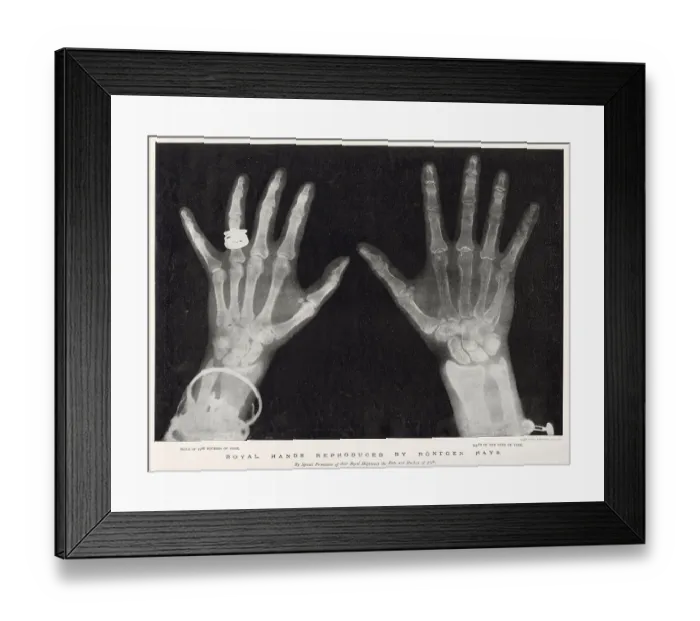 Framed Print : Royal Hands Reproduced by Rontgen Rays Framed Print : Royal Hands Reproduced by Rontgen Rays