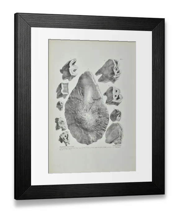 Framed Print : Teeth and bony base of the nose of Rhinoceros, Kent's Cavern Framed Print : Teeth and bony base of the nose of Rhinoceros, Kent's Cavern