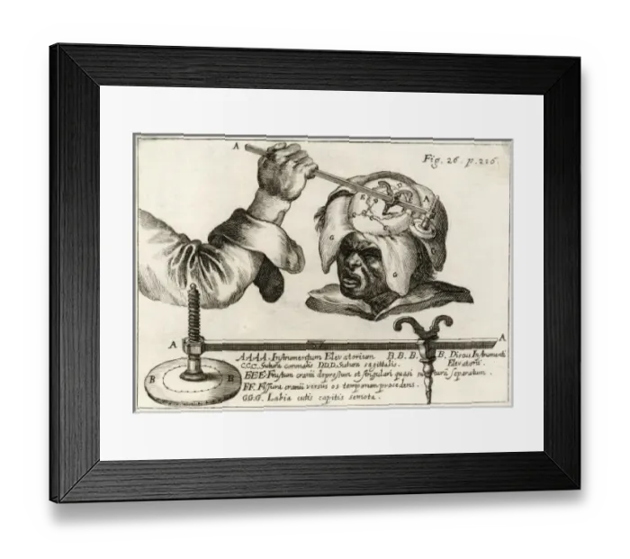 Framed Print : Operation on Skull Framed Print : Operation on Skull