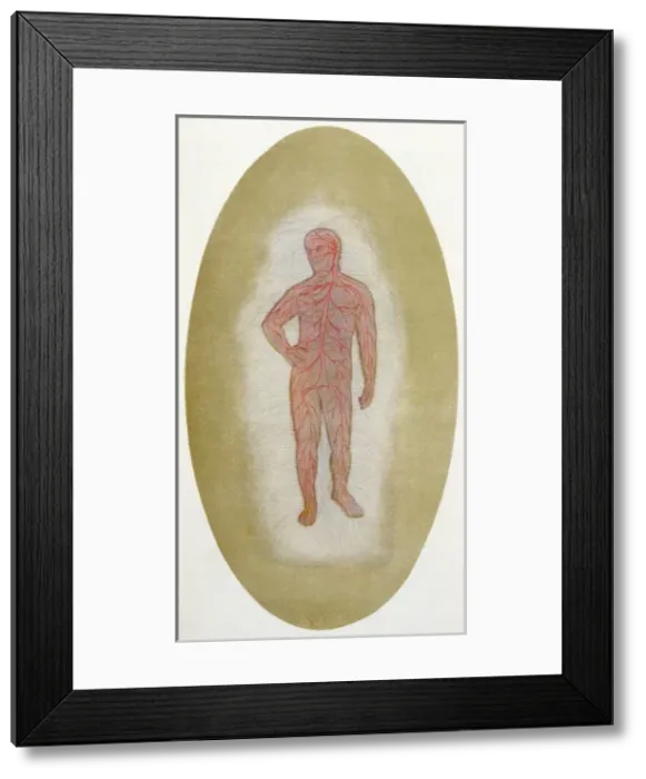 Framed Print : Etheric Double Sick Framed Print : Etheric Double Sick