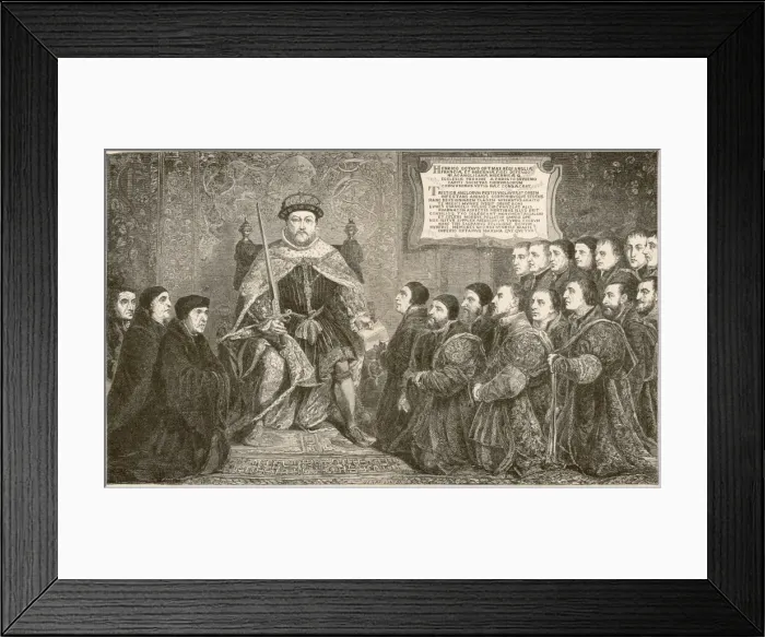 Framed Print : Henry VIII & Surgeons Framed Print : Henry VIII & Surgeons