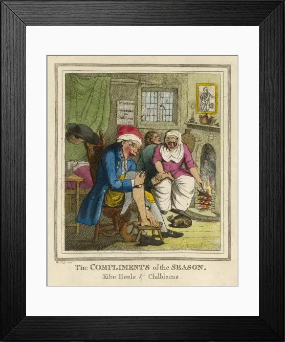 Framed Print : Suffering Chilblains Framed Print : Suffering Chilblains