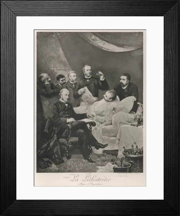 Framed Print : Lithotritie Operation Framed Print : Lithotritie Operation