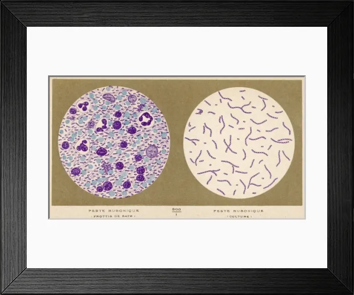 Framed Print : Bubonic Plague Bacillus Framed Print : Bubonic Plague Bacillus