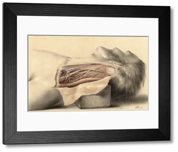 Framed Print : Anatomy / Side of Neck Framed Print : Anatomy / Side of Neck