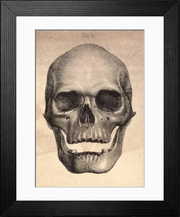Framed Print : Human Skull / 1841 Framed Print : Human Skull / 1841