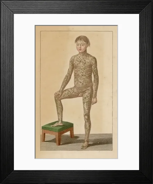 Framed Print : Rashful Youth Framed Print : Rashful Youth