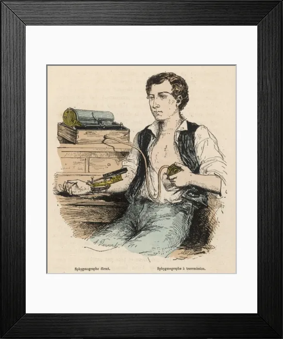 Framed Print : Sphygmograph / 1881 Framed Print : Sphygmograph / 1881
