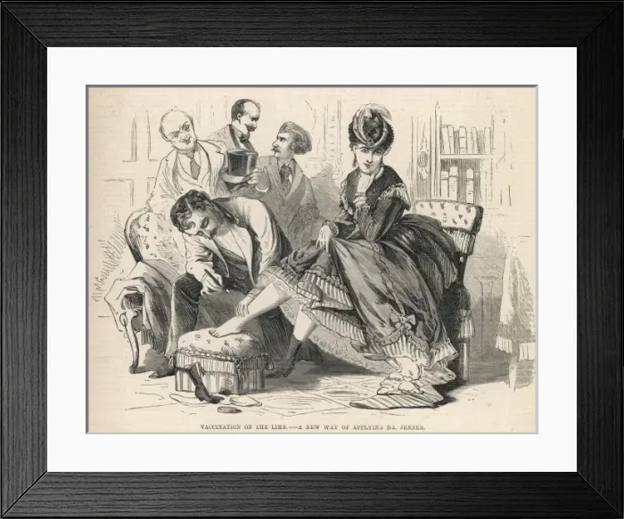 Framed Print : Smallpox Vaccination Framed Print : Smallpox Vaccination