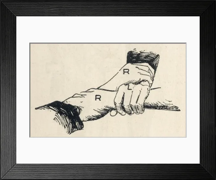 Framed Print : First aid, carrying patient using three interlocked hands Framed Print : First aid, carrying patient using three interlocked hands