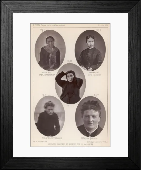 Framed Print : French Mental Patients Framed Print : French Mental Patients
