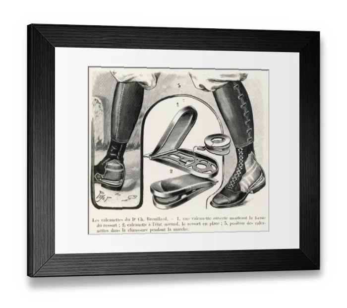 Framed Print : Breuillards device to assist walking Framed Print : Breuillards device to assist walking