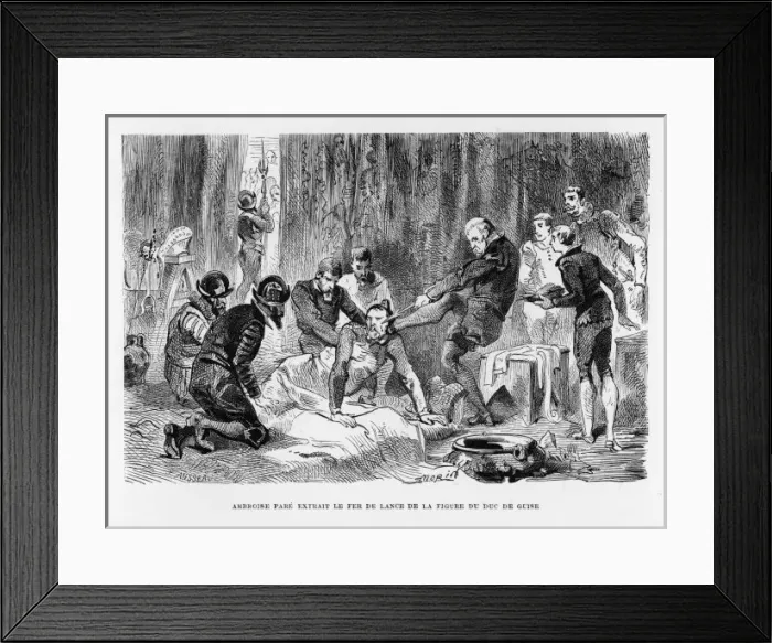 Framed Print : AMBROISE PARE 1510-1590 Framed Print : AMBROISE PARE 1510-1590