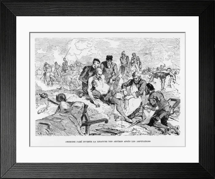Framed Print : Ambroise Pare Surgeon Framed Print : Ambroise Pare Surgeon