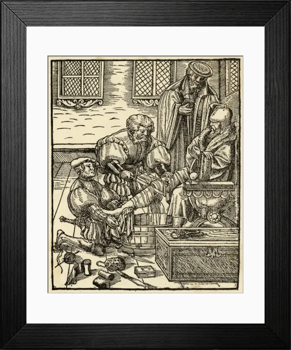Framed Print : Amputating a Leg C16 Framed Print : Amputating a Leg C16