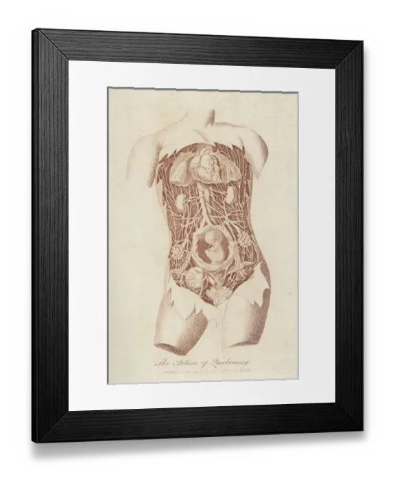 Framed Print : Foetus in the Womb Framed Print : Foetus in the Womb