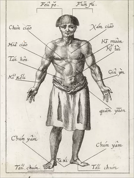 Acupuncture in 17th Cent