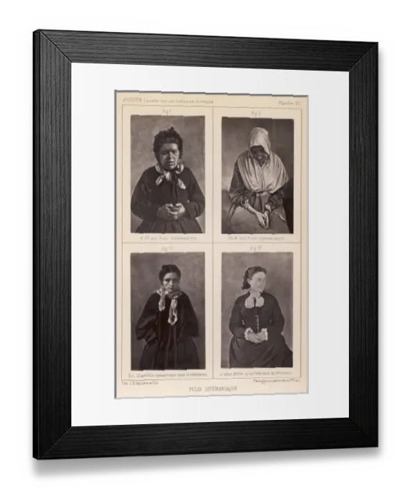 Framed Print : French Mental Patients 2 Framed Print : French Mental Patients 2