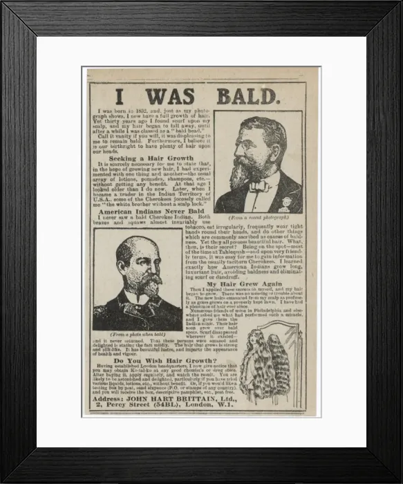 Framed Print : Baldness Cured 1919 Framed Print : Baldness Cured 1919