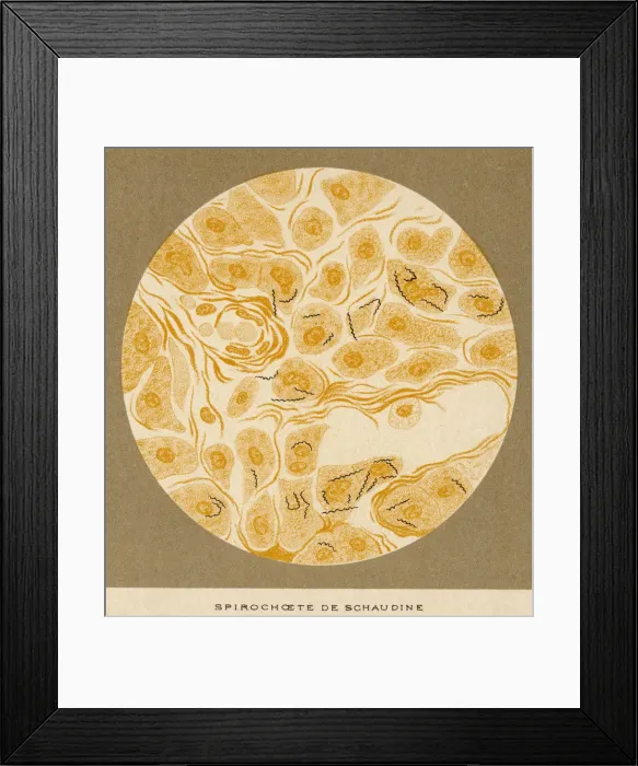 Framed Print : Syphilis Spirochaete Framed Print : Syphilis Spirochaete