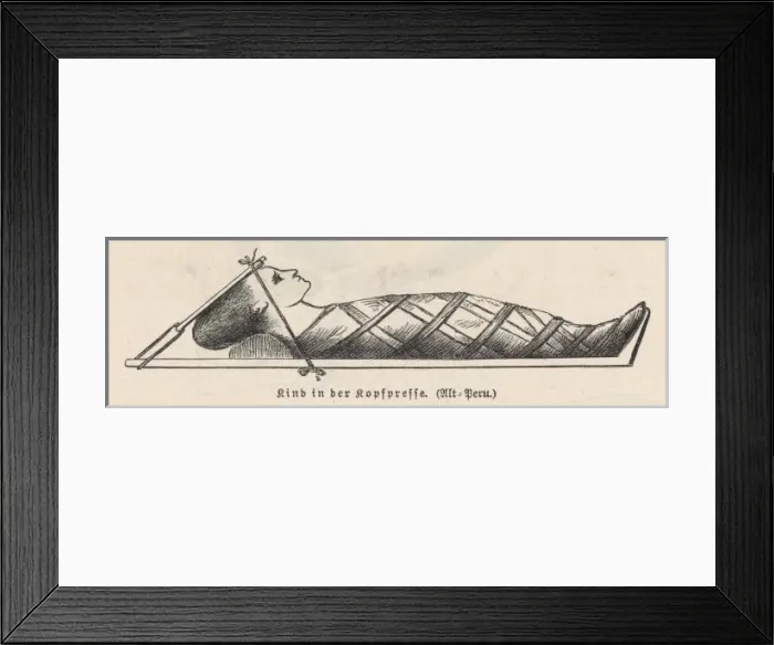 Framed Print : Compression of Head Framed Print : Compression of Head