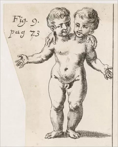 Two-Headed Child  /  1691