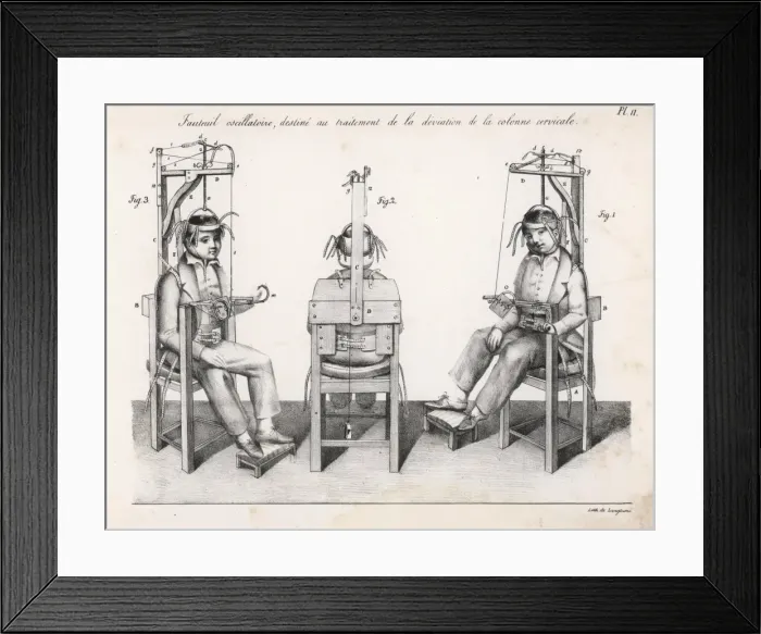 Framed Print : Treating the Spine (4) Framed Print : Treating the Spine (4)