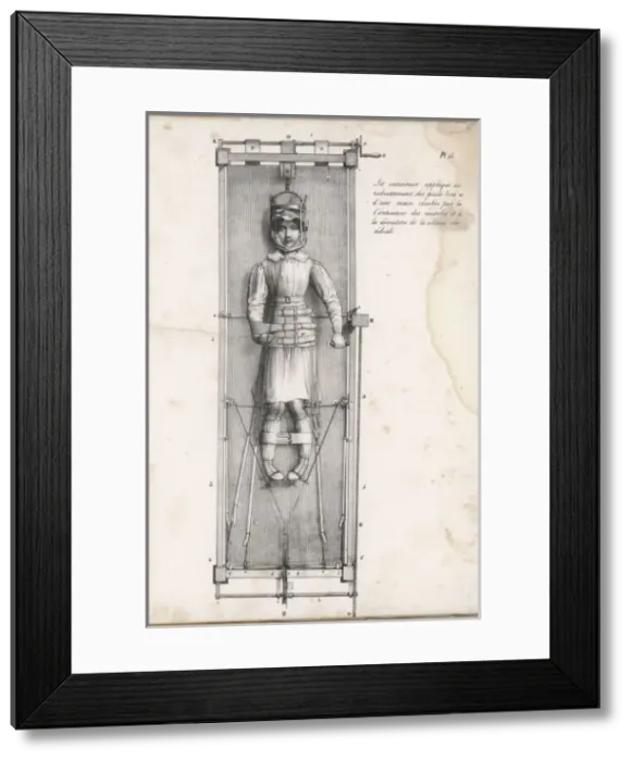 Framed Print : Treating Bow Legs Framed Print : Treating Bow Legs