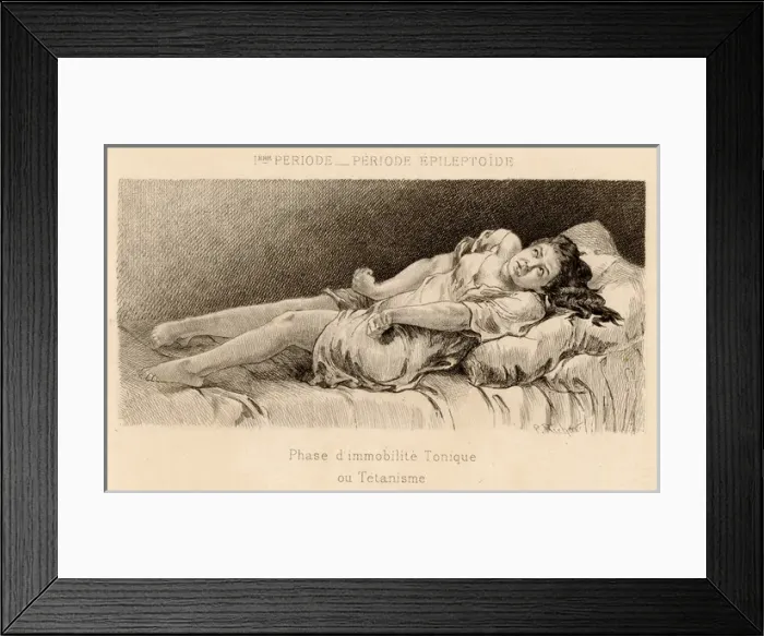 Framed Print : Insanity / Hysteria / 1881 Framed Print : Insanity / Hysteria / 1881