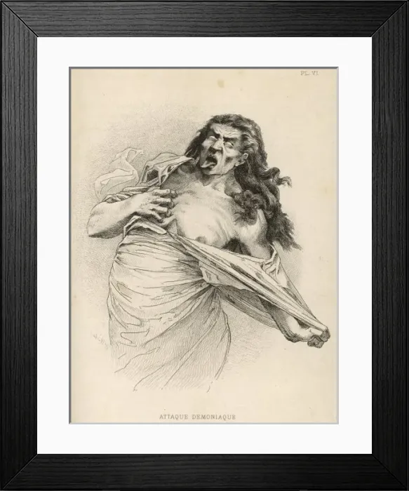 Framed Print : Insanity / Hysteria / 1881 Framed Print : Insanity / Hysteria / 1881