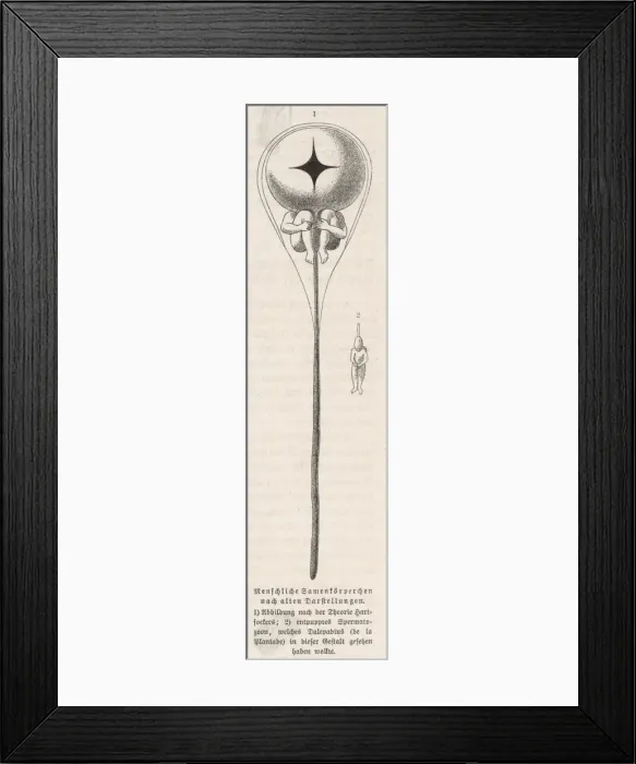 Framed Print : Male Spermatozoa Framed Print : Male Spermatozoa