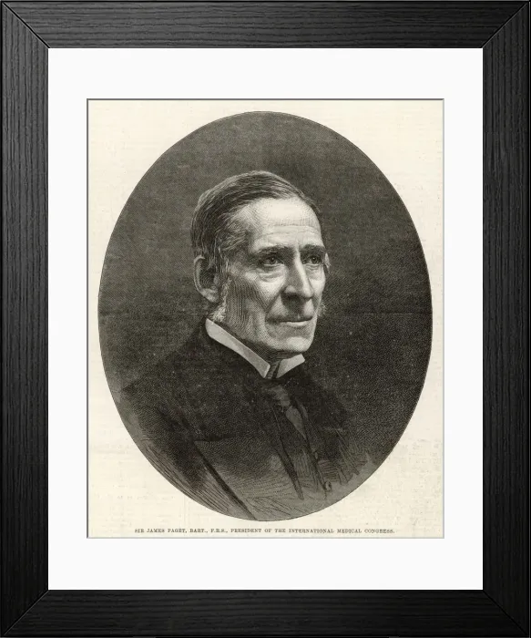 Framed Print : Sir James Paget / Iln 1881 Framed Print : Sir James Paget / Iln 1881