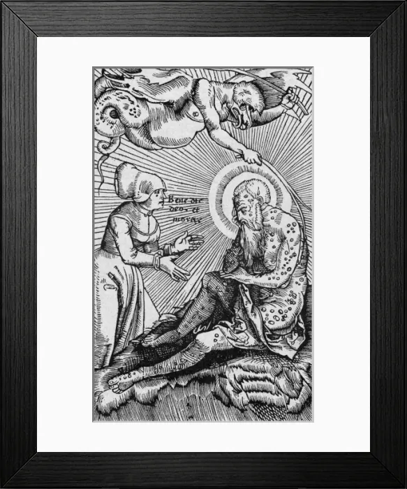 Framed Print : Medical / Ailments / Leprosy Framed Print : Medical / Ailments / Leprosy