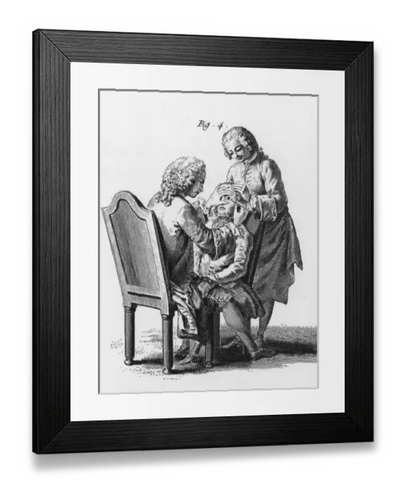 Framed Print : Eye Operation / C. 1760 Framed Print : Eye Operation / C. 1760