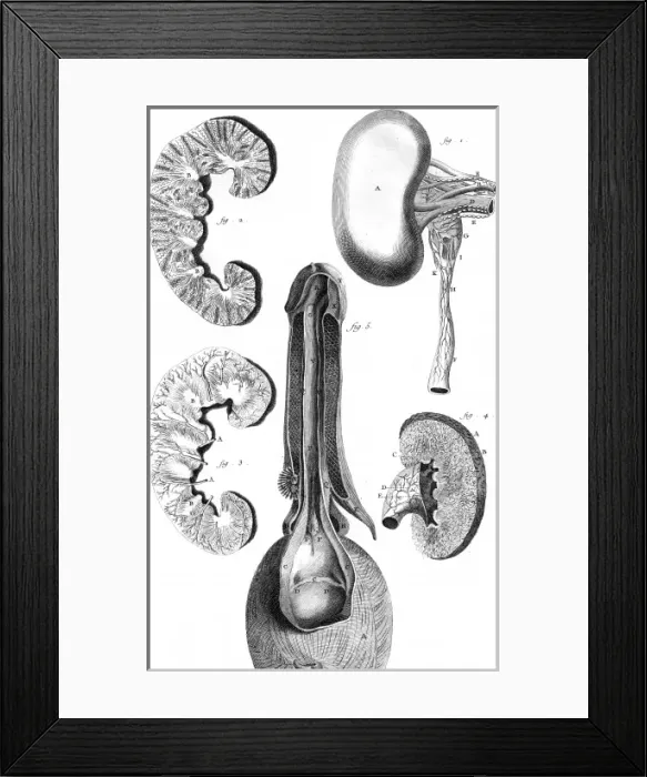 Framed Print : Kidney & Bladder 18th C Framed Print : Kidney & Bladder 18th C