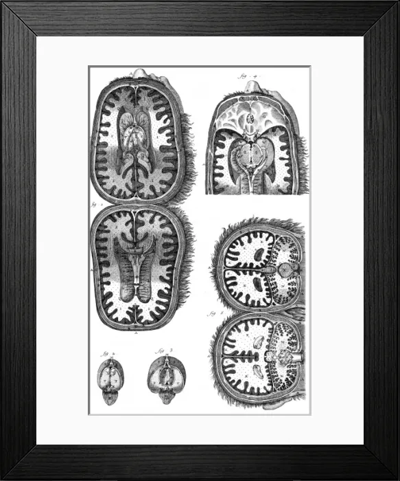 Framed Print : Brain Cavities 18th C