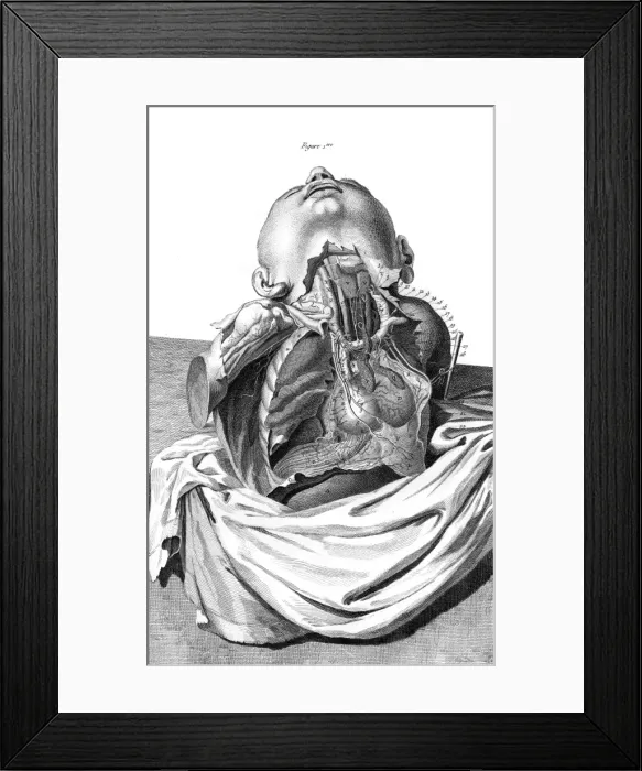 Framed Print : Heart & Chest Arteries Framed Print : Heart & Chest Arteries