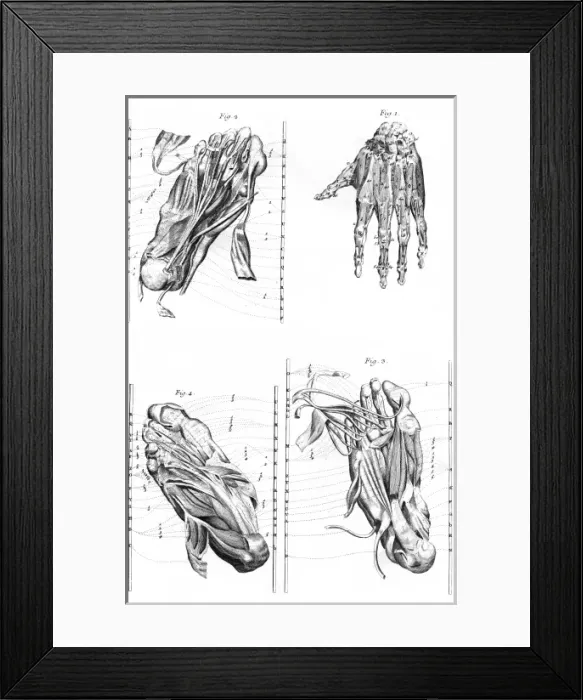 Framed Print : Muscles of Hand and Foot Framed Print : Muscles of Hand and Foot