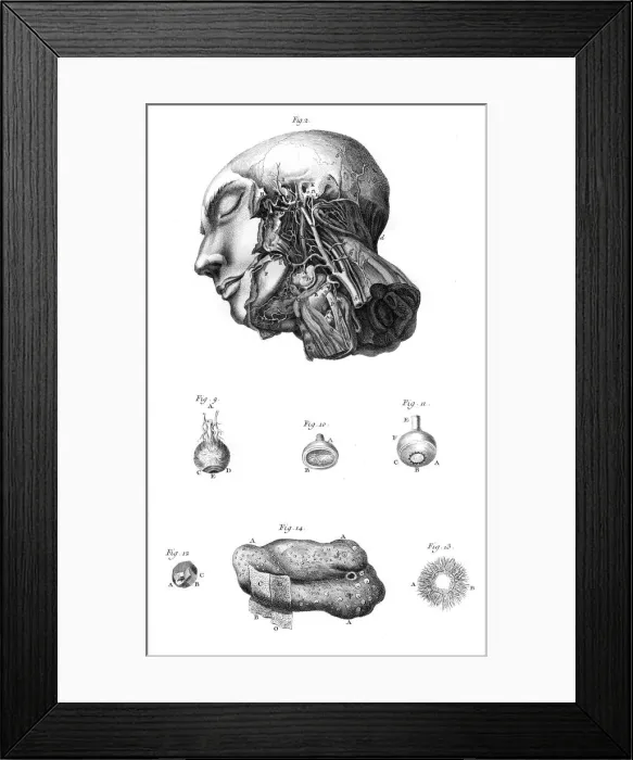 Framed Print : Arteries of the Face Framed Print : Arteries of the Face