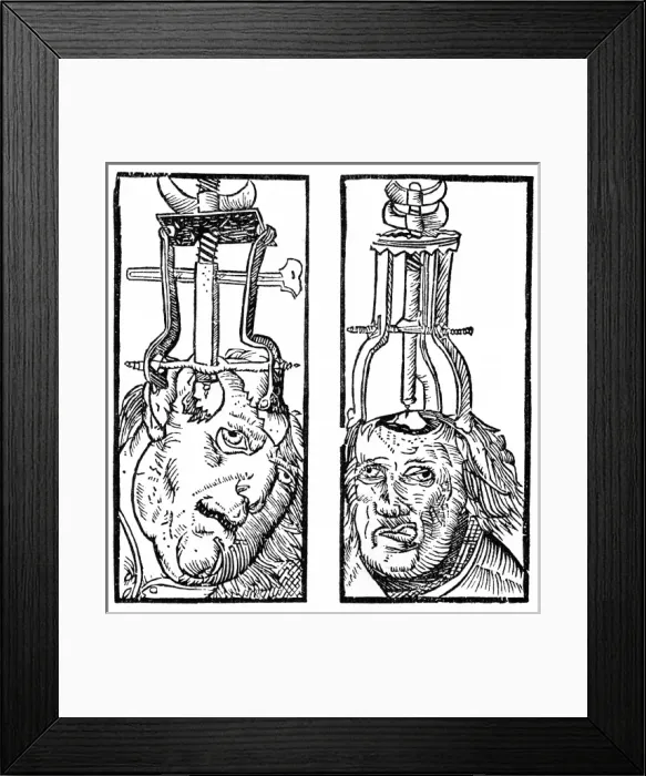Framed Print : Surgical Operations Framed Print : Surgical Operations