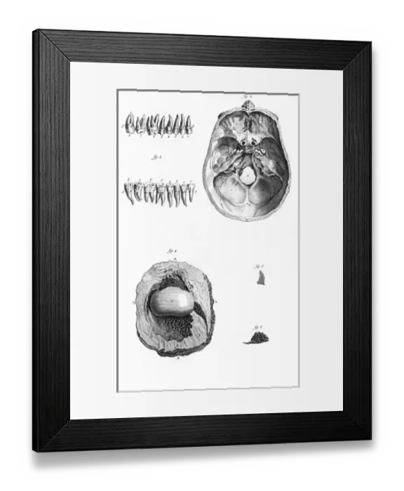 Framed Print : Anatomy in the 18th C Framed Print : Anatomy in the 18th C